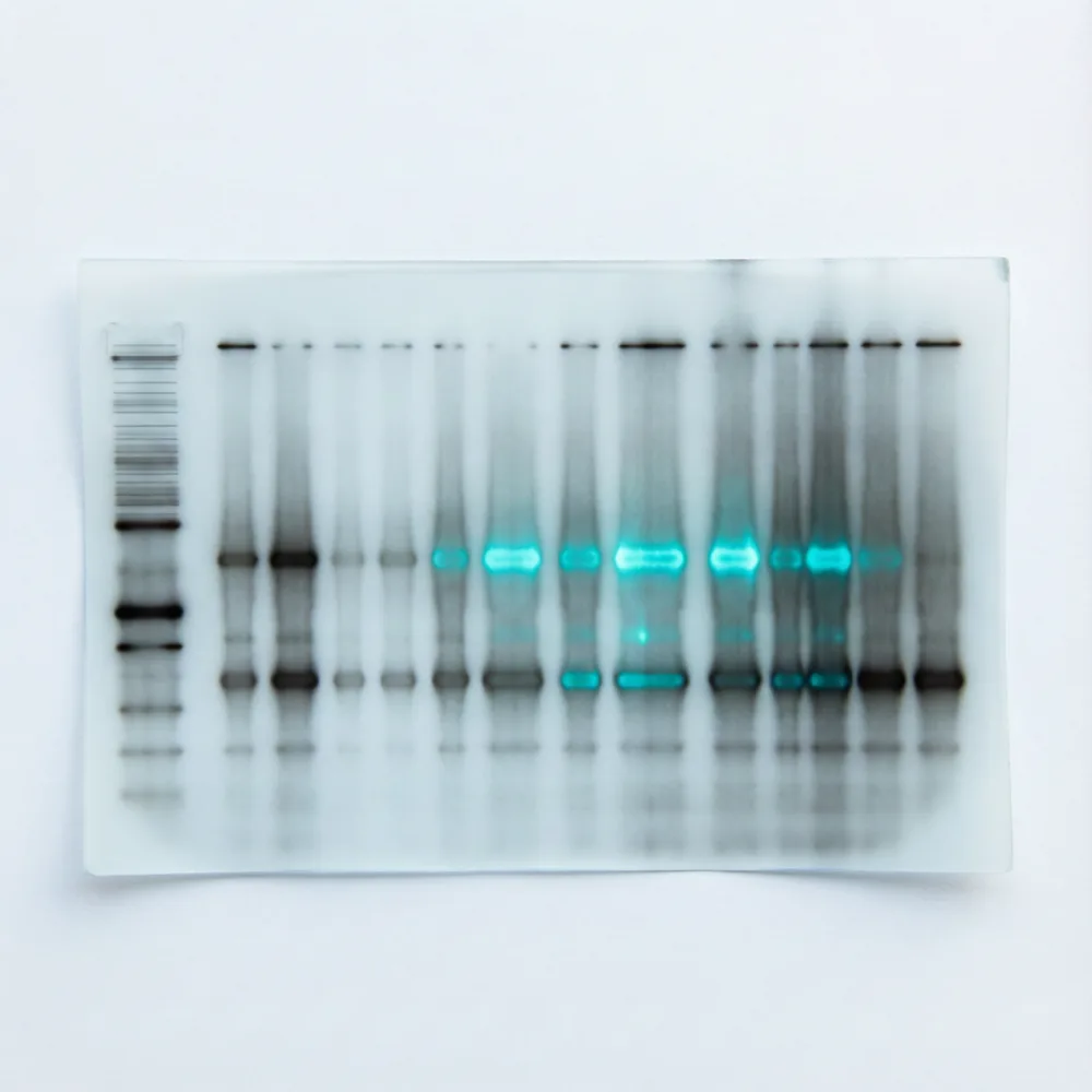 Total Protein Itaconylation Kit for WB (Cell Labeling) 全蛋白衣康酸免疫印迹法试剂盒（细胞标记）
